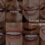 Success Stories, Dr. Gonzaga Tabares: Transformations with Porcelain and Resin Veneers and Custom Designs. Smiles That Change Lives. / Casos de éxito del Dr. Gonzaga Tabares: carillas de porcelana, resina y diseño personalizado. Sonrisas que cambian vidas en Cali y Punta Cana.
